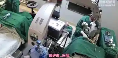 广西贵港 爱尔眼科医院 院长冯桂强 在为一名82岁患者进行手术时 对其头部挥拳猛击 只因患者喊疼